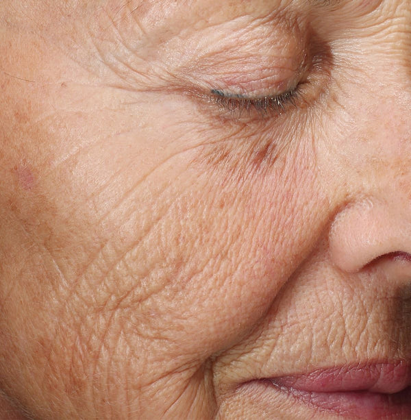 Best_anti-aging_skincare_for_wrinkles_in_Pakistan_By_B_B_Derma